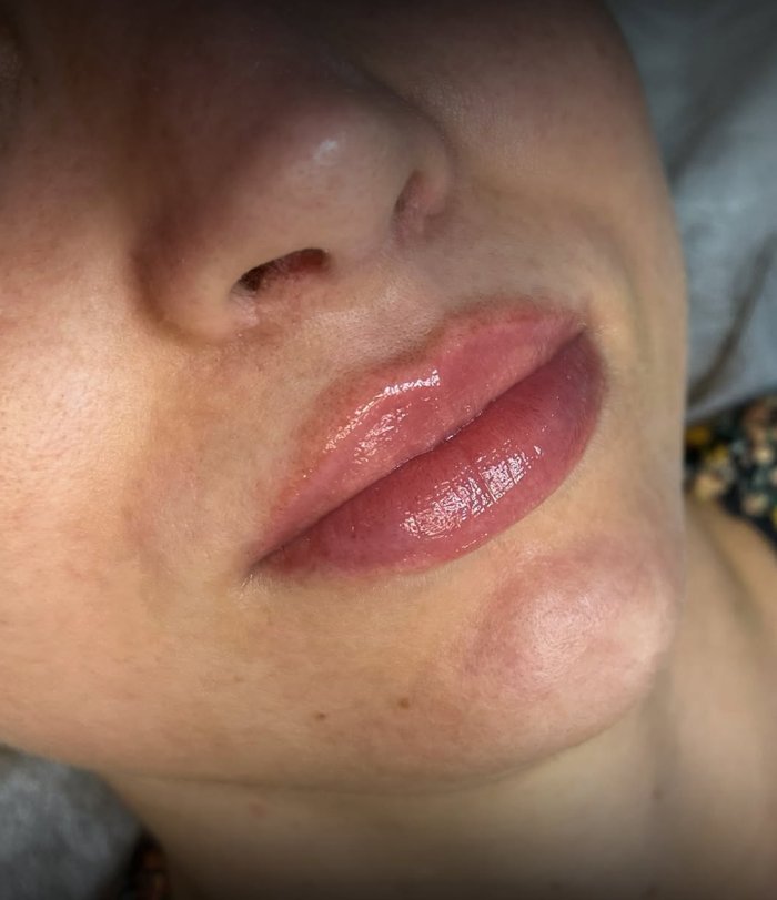 Lábios hidratados e com brilho após Nutri Gloss
