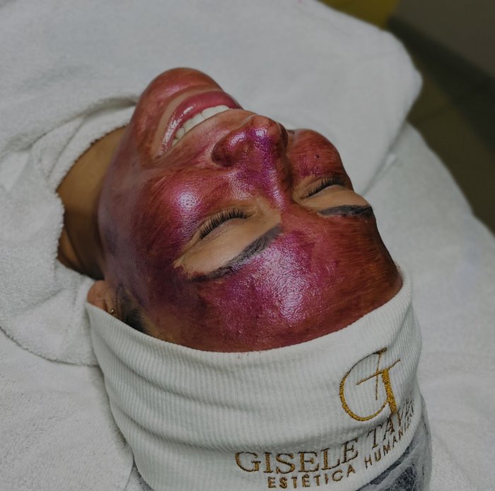 Cliente com máscara de peeling aplicada no rosto